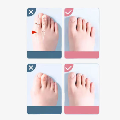 Feral Walk™ Silicone Toe Separator